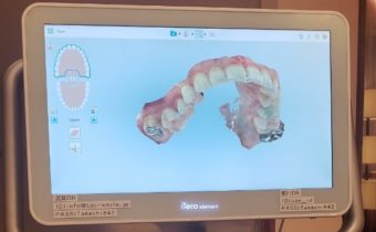 矯正終了まで、あと2週間！