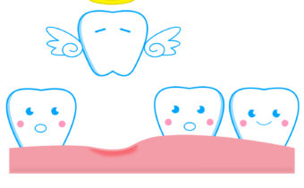 奥歯が抜けたまま放置されると・・・